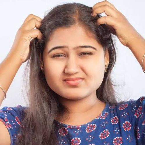 Dandruff